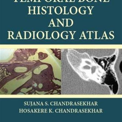 Temporal Bone Histology and Radiology Atlas