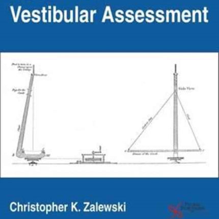 Rotational Vestibular Assessment