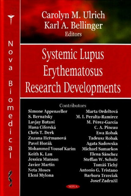 Systemic Lupus Erythematosus Research