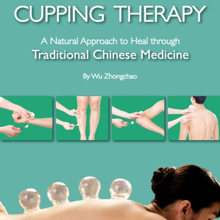 A Practical Guide to Cupping Therapy: A Natural