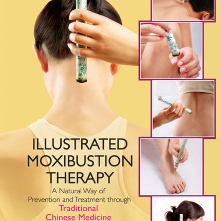 The Illustrated Moxibustion Therapy: A Natural Way of Prevention and Treatment through Traditional Chinese Medicine