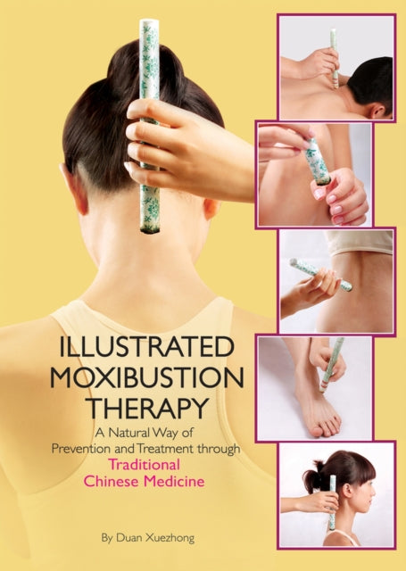 The Illustrated Moxibustion Therapy: A Natural Way of Prevention and Treatment through Traditional Chinese Medicine