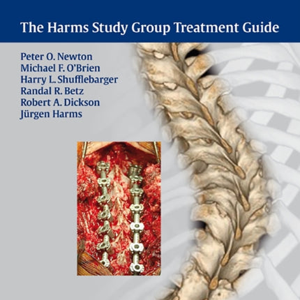 Idiopathic Scoliosis: The Harms Study Group Treatment Guide