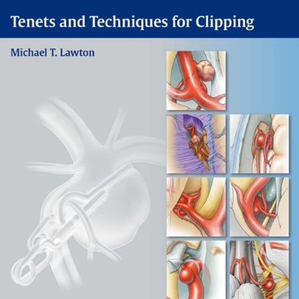 Seven Aneurysms: Tenets and Techniques for Clipping