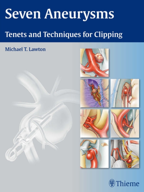 Seven Aneurysms: Tenets and Techniques for Clipping