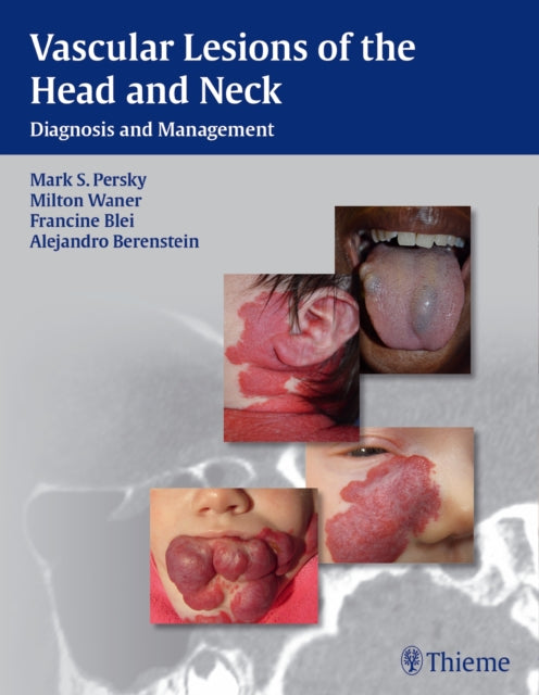 Vascular Lesions of the Head and Neck: Diagnosis and Management