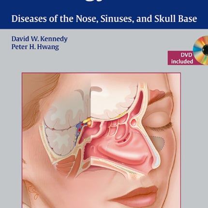 Rhinology: Diseases of the Nose, Sinuses, and