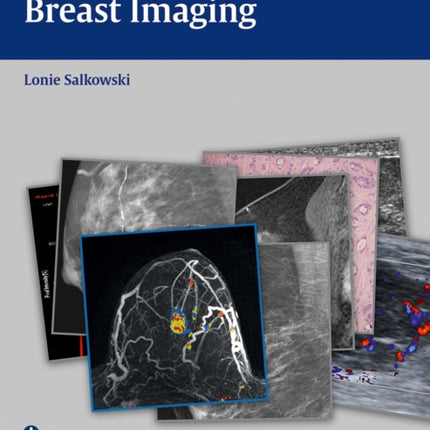 Radcases Breast Imaging