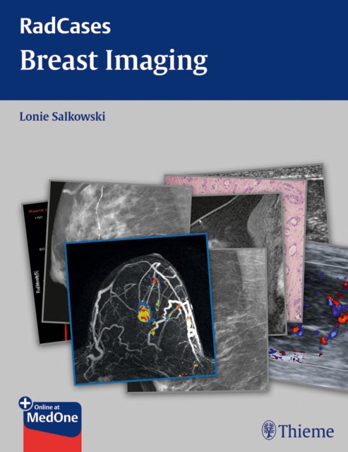 Radcases Breast Imaging