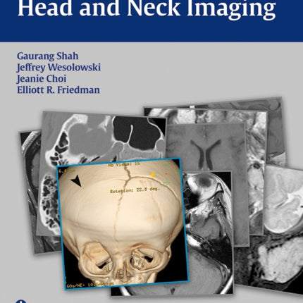 RadCases Head and Neck Imaging