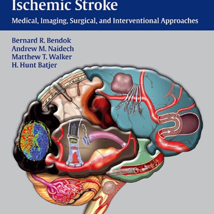 Hemorrhagic and Ischemic Stroke: Medical, Imaging, Surgical and Interventional Approaches