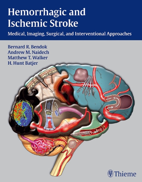 Hemorrhagic and Ischemic Stroke: Medical, Imaging, Surgical and Interventional Approaches