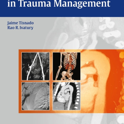 Interventional Radiology in Trauma