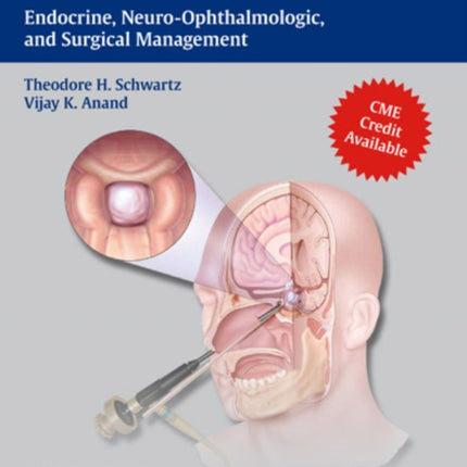 Endoscopic Pituitary Surgery: Endocrine, Neuro-Ophthalmologic, and Surgical Management