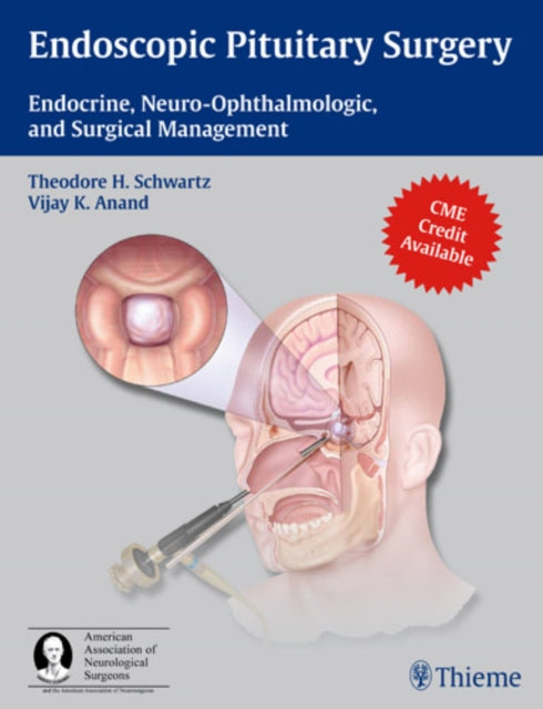 Endoscopic Pituitary Surgery: Endocrine, Neuro-Ophthalmologic, and Surgical Management