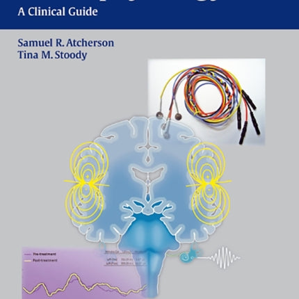 Auditory Electrophysiology: A Clinical Guide