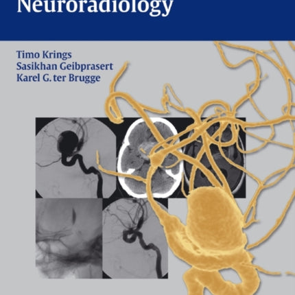 Case-Based Interventional Neuroradiology