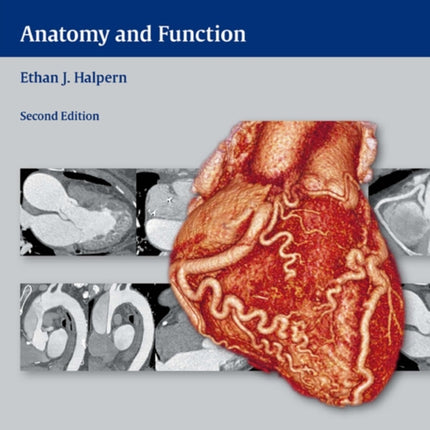 Clinical Cardiac CT: Anatomy and Function