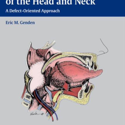 Reconstruction of the Head and Neck: A Defect-Oriented Approach