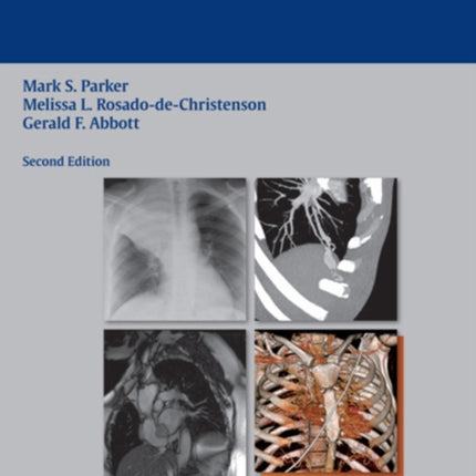 Chest Imaging Case Atlas