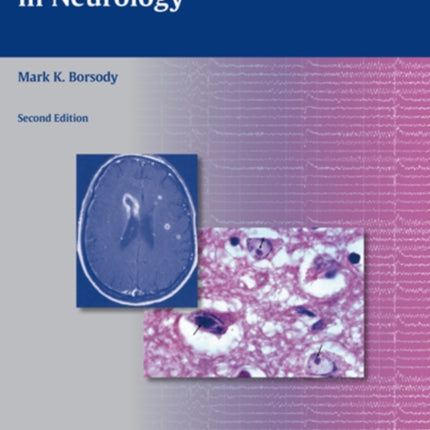 Comprehensive Board Review in Neurology