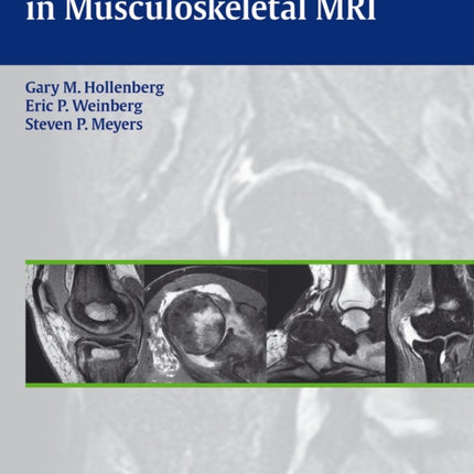 Differential Diagnosis in Musculoskeletal MR