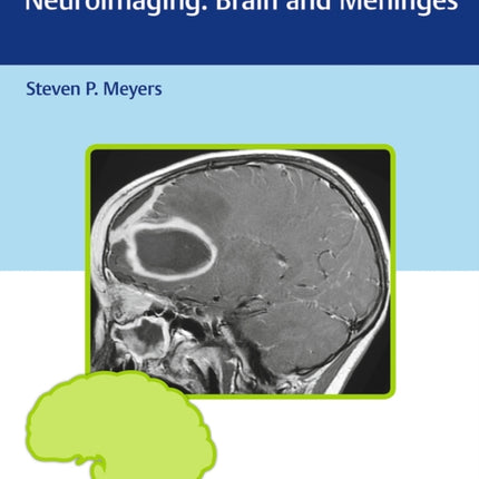 Differential Diagnosis in Neuroimaging: Brain and Meninges