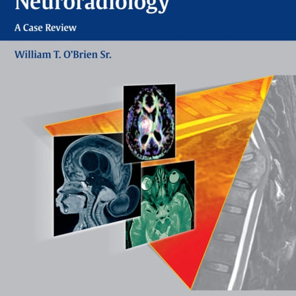 Top 3 Differentials in Neuroradiology: A Case Review