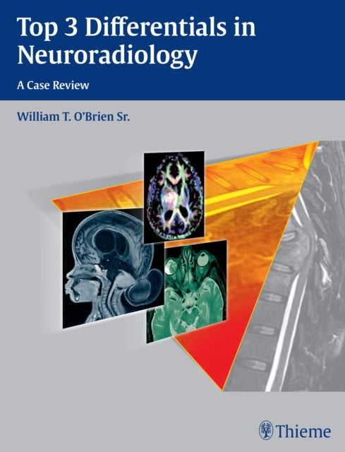 Top 3 Differentials in Neuroradiology: A Case Review