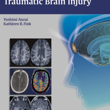 Imaging of Traumatic Brain Injury