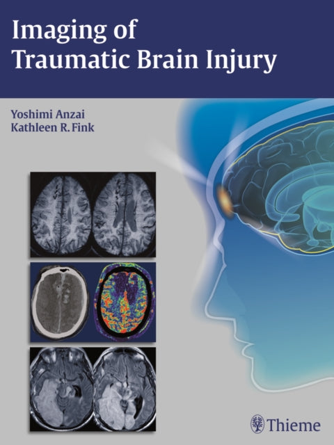 Imaging of Traumatic Brain Injury