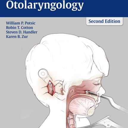 Surgical Pediatric Otolaryngology