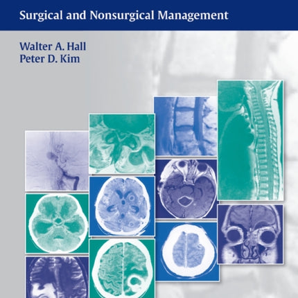 Neurosurgical Infectious Disease: Surgical and Nonsurgical Management