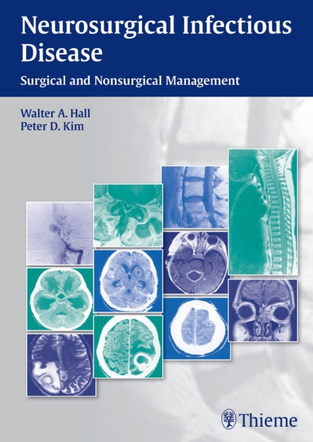 Neurosurgical Infectious Disease: Surgical and Nonsurgical Management