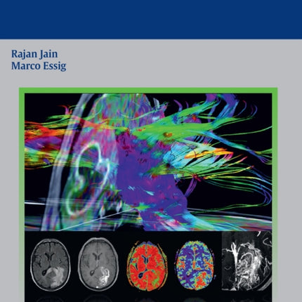 Brain Tumor Imaging