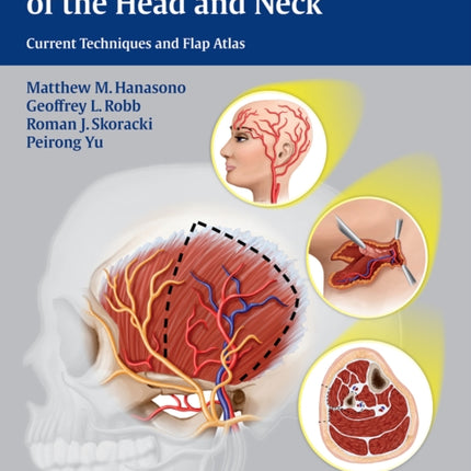 Reconstructive Plastic Surgery of the Head and Neck: Current Techniques and Flap Atlas