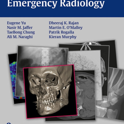 Radcases Emergency Radiology