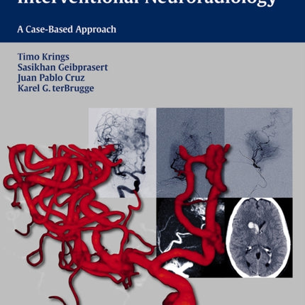 Neurovascular Anatomy in Interventional Neuroradiology: A Case-Based Approach