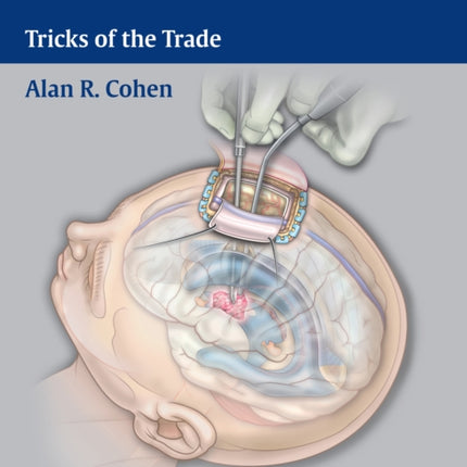 Pediatric Neurosurgery: Tricks of the Trade