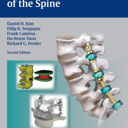 Dynamic Reconstruction of the Spine