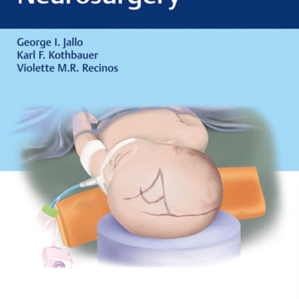 Handbook of Pediatric Neurosurgery