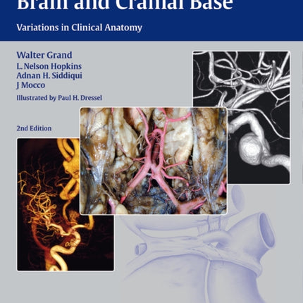 Vasculature of the Brain and Cranial Base