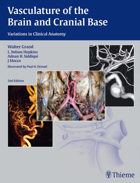 Vasculature of the Brain and Cranial Base