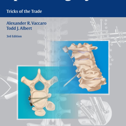 Spine Surgery: Tricks of the Trade