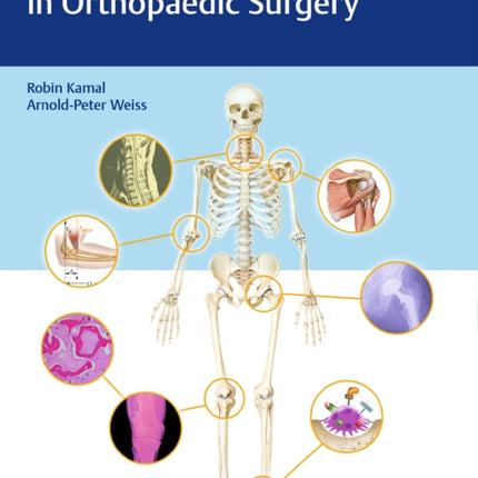 Comprehensive Board Review in Orthopaedic Surgery