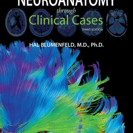 Neuroanatomy through Clinical Cases