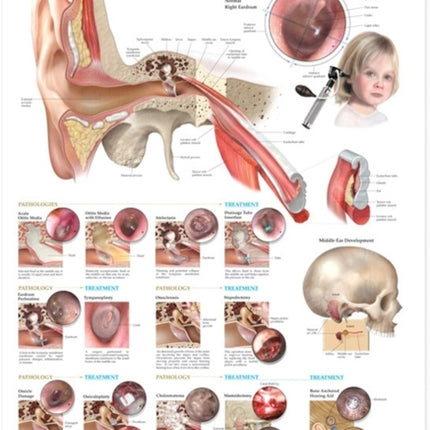 Middle Ear Conditions Anatomical Chart