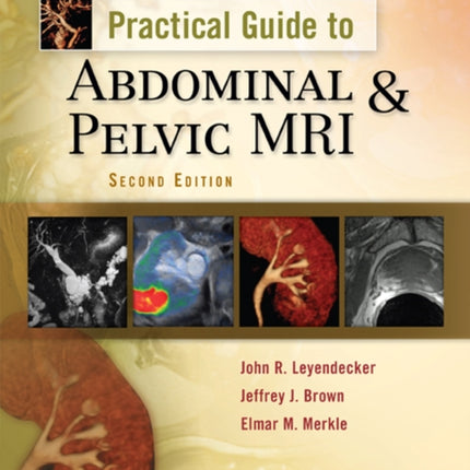 Practical Guide to Abdominal and Pelvic MRI