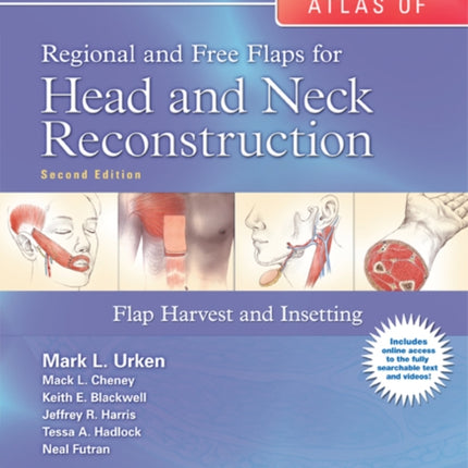 Atlas of  Regional and Free Flaps for Head and Neck Reconstruction: Flap Harvest and Insetting