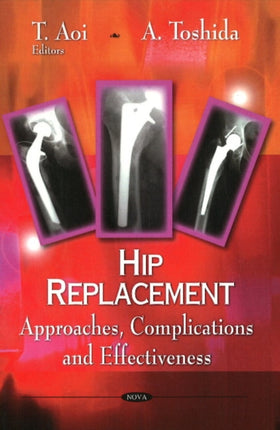 Hip Replacement: Approaches, Complications & Effectiveness